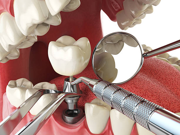Best Emergency Dental Services for Seniors in Maria Stein, OH